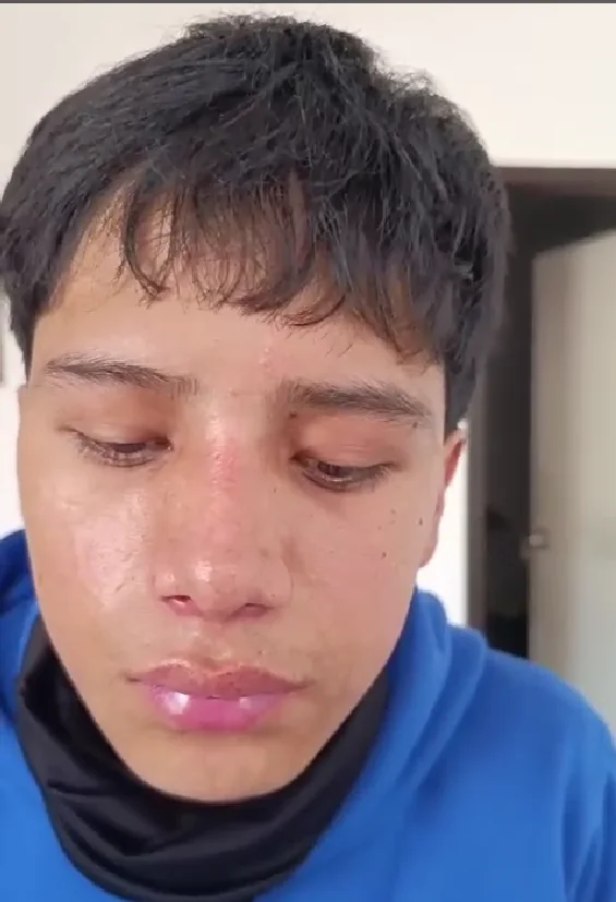 Caso 3, después (1 de 3)